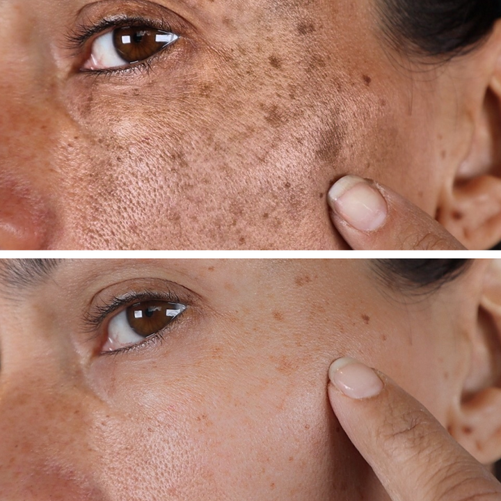 Melanin Correcting Facial Serum