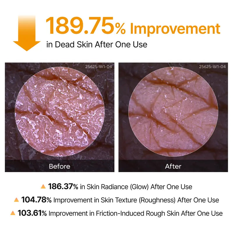 Keratin Peel Shot