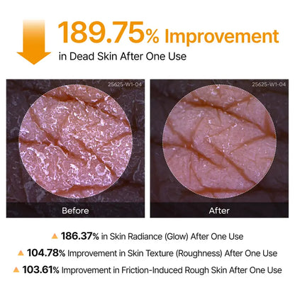 Keratin Peel Shot